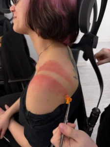 ustioni-da-calore-trucco-sfx I grado