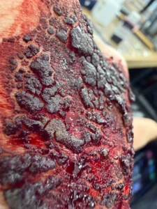 ustioni-da-calore-trucco-sfx III grado